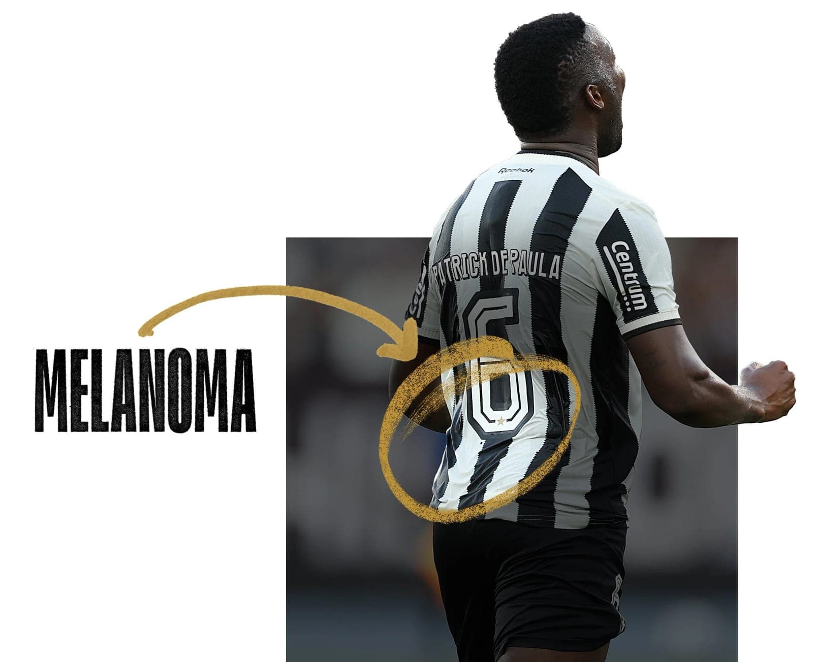 Botafogo player Patrick de Paula seen from behind, with a gold arrow from the word Melanoma to a circle around the tiny dot on his shirt